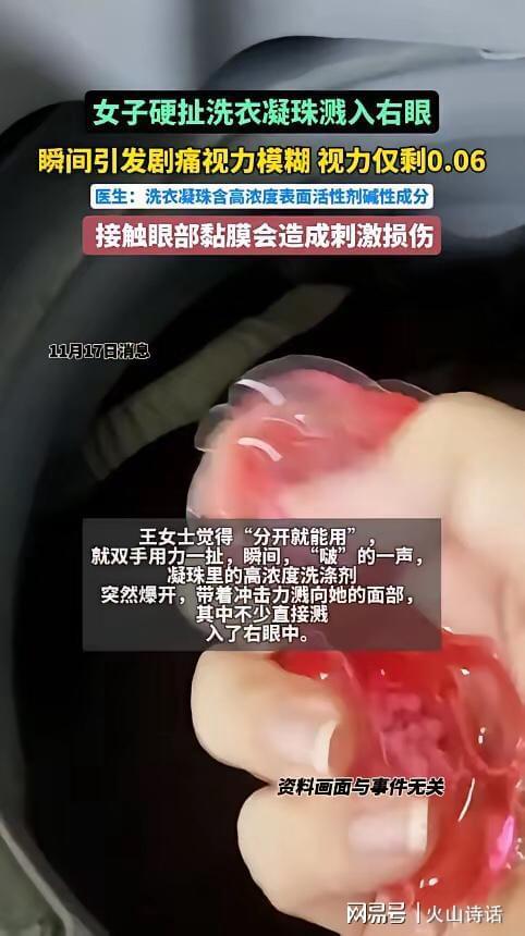 杭州一女子撕扯凝珠发生意外致眼睛失明开元ky棋牌恐怖！洗衣引发“爆炸”(图2)